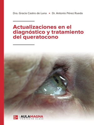 cover image of Actualizaciones en el diagnóstico y tratamiento del queratocono